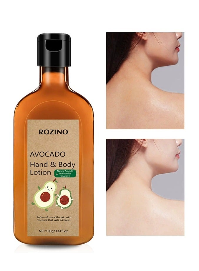 Avocado body lotion for dry skin in autumn and winter, moisturizing, anti-itching and hydrating avocado body lotion