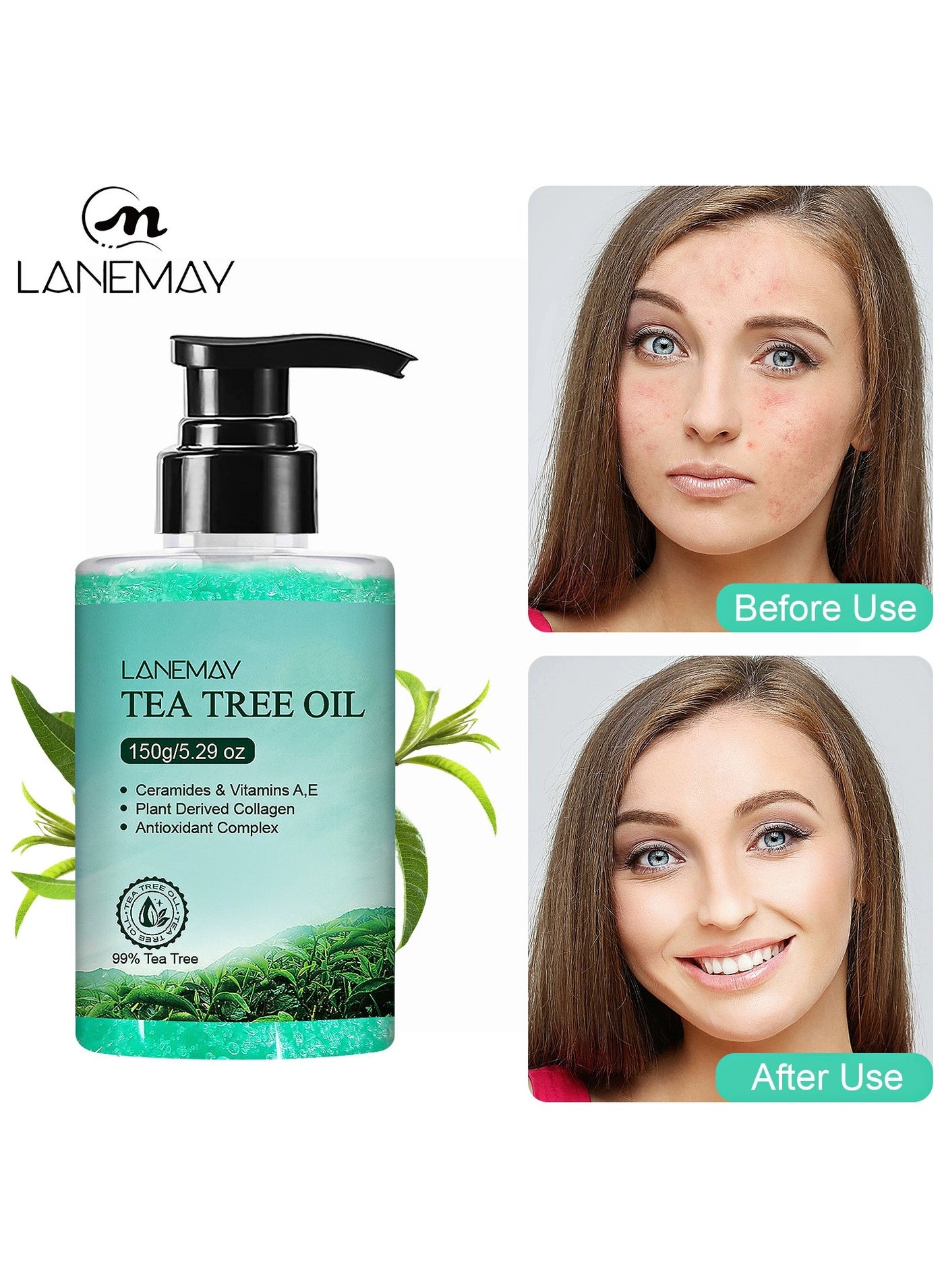 Tea Tree Essence Gel Facial Hydrating Serum – Brightening Firming Pore Minimizing, Oil-Control Formula
