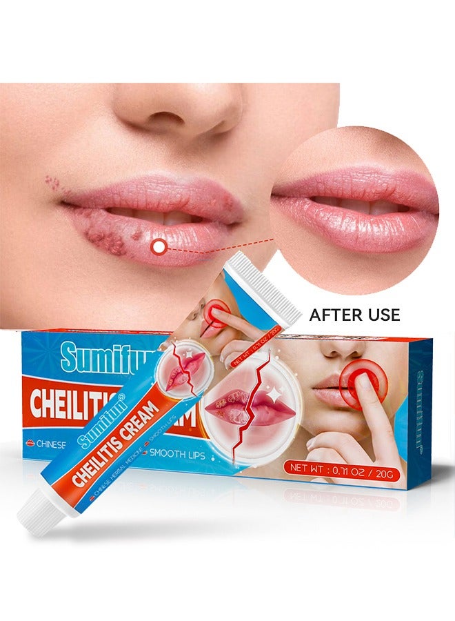 Cheilitis Cream-Chinese Herbal Medicine Smooth Lips,Repairing Chapped and Dry Lips | Natural Ingredients for Instant Cooling and Pain Relief | Dead Skin Removal/Fade Lip Lines/Improve Lip Color