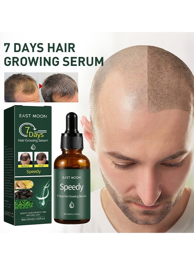 7 Days Hair Growing Serum 30ml, Ginger Rapid Growth Hair Treatment, Anti Hair Loss Hair Regrowth Essence, Nourishing Hair Care Essential Oil