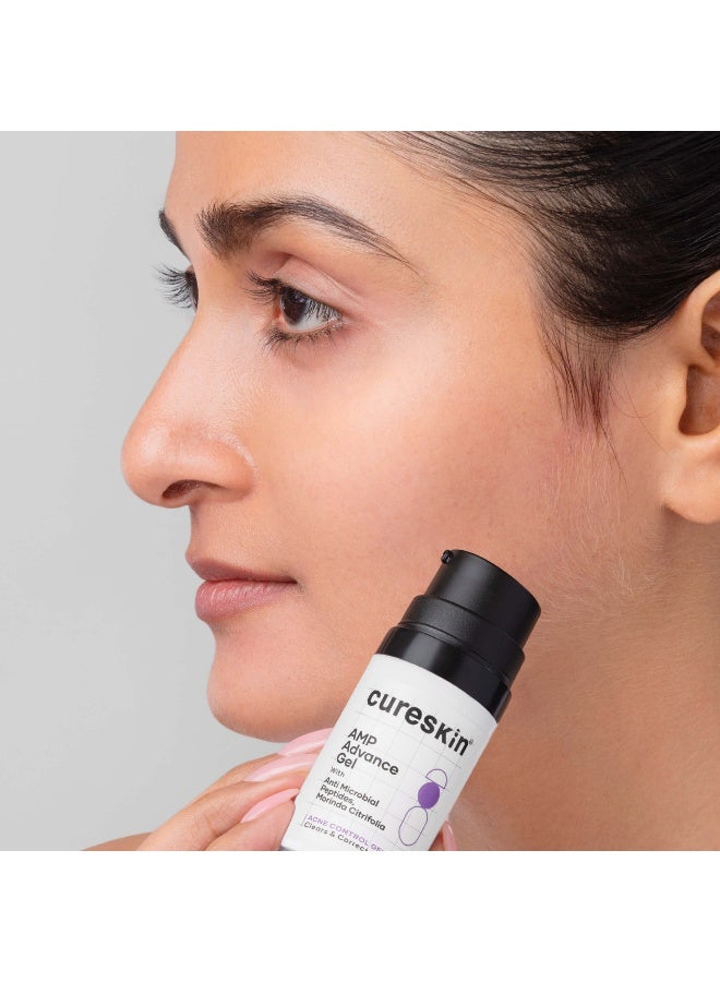 Acne Control Gel with Azelaic Acid, Mandelic Acid & Probiotics | Reduces Pimples, Blemishes & Excess Oil | For Oily & Acne-Prone Skin | 10 g - image 3