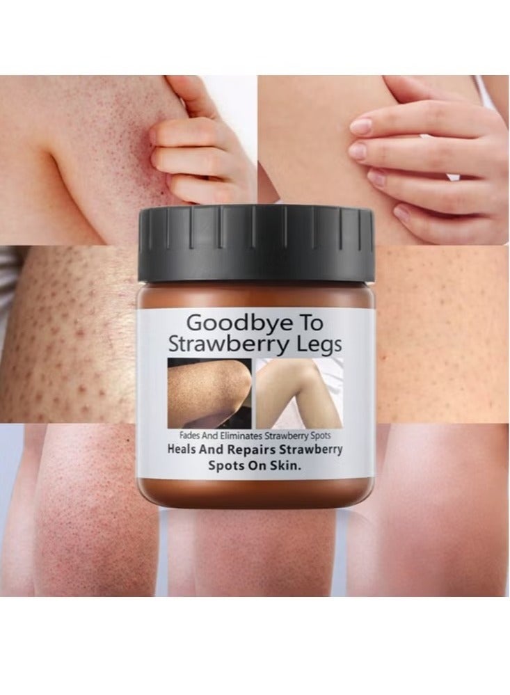 Women's Strawberry Legs Treatment, Rough Bump Body Cream, Dry Skin Lotion, Strawberry Skin Remover, Pilaris Keratosis Pilaris Treatment Moisturising Cream Body Moisturiser For Brightening Dry Areas