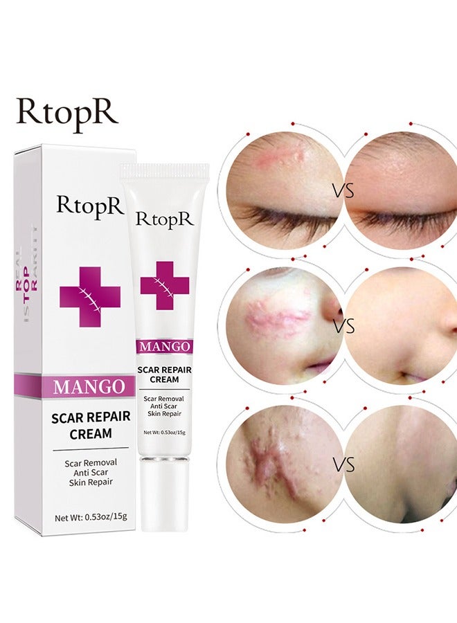 Scar Repair Cream-Skin Repair Creams Treatment Stretch Marks Acne Surgical Care 15g