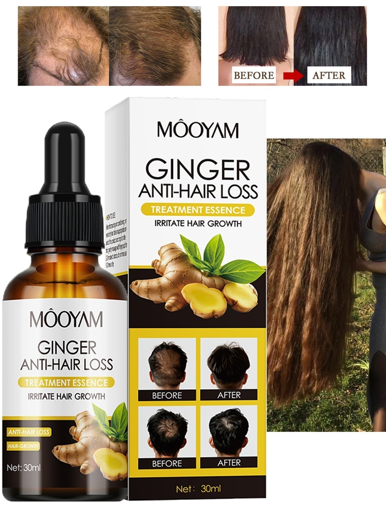 Ginger Hair Growth Essence 30ml Anti Hair Loss Treatment Strengthens Hair Follicles Reduces Breakage and Promotes Thicker Fuller Hair for All Hair Types