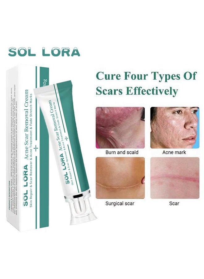 Acne Scar Removal Cream，Scar Erase ，Scar Removal Gel，Acne Scar Treatment，Deep Acne Scar Removal， Burns Keloids Hypertrophic， Repair Damaged Skin，Removing Acne Marks Scar Repair Cream ﻿30g