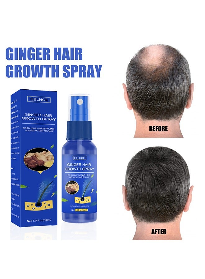 Ginger Hair Growth Spray,Ginger Herb Formula Stop Hair Loss Hair Regrowth Treatments Grow Thicker Longer Hair Accelerate Hair Growth for Men and Women 30ml