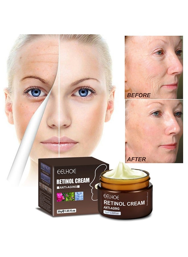 Retinol Cream Ant-Aging， Wrinkle Firming Cream, Retinol Firming and Revitalizing Cream 30g