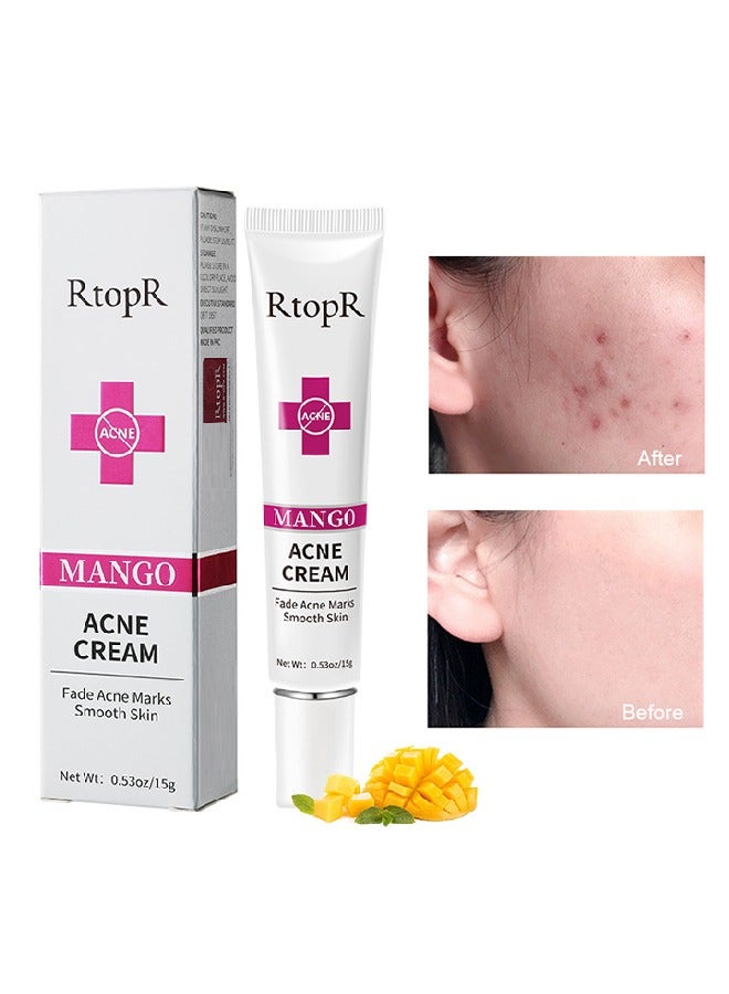 Mango Acne Cream,Acne Treatment Face Cream, Acne Spot Treatment for Face and Acne Dots, Natural Cystic Acne Treatment, For All Skin Types, Premium Acne Scar Cream and Pimple Remover 15g