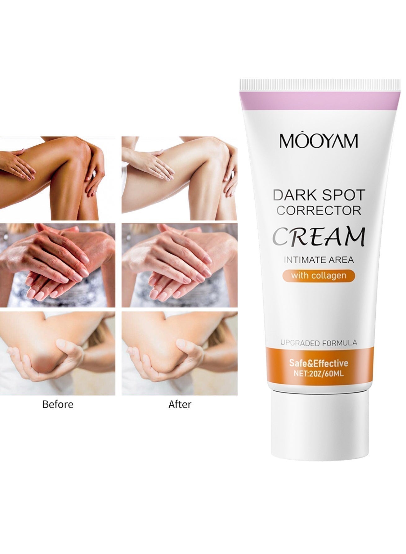 Dark Spot Corrector Cream 60ml for Underarms Neck Knees and Elbows Brightening Treatment Moisturizes Skin and Evens Tone for All Skin Types