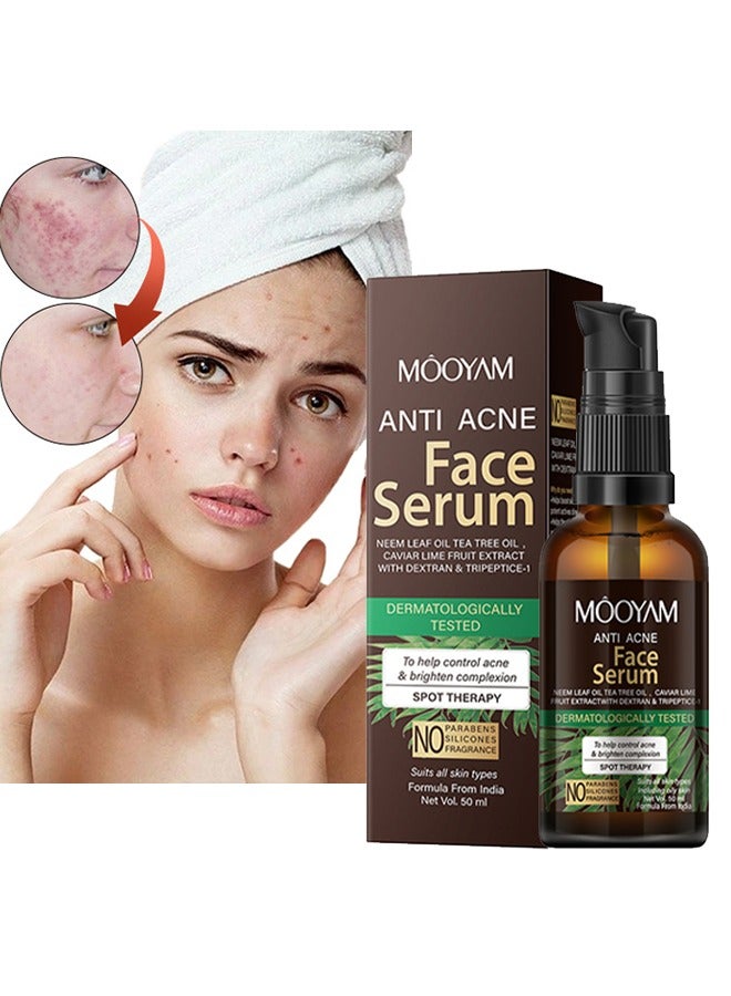 Anti Acne Face Serum, Neem Leaf Oil, Tea Tree Oil, Caviar Lime Fruit Extract with Dextran & Tripeptice-1 and Lemon Anti-Acne Face, Anti-wrinkle firming, Whitening Facial Repair Serum 50ml, for Acne Prone Skin Type