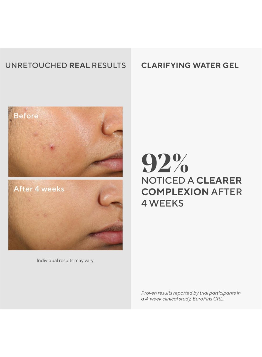 Murad Clarifying Water Gel 60ml – Oil-Free Hydration for Acne-Prone Skin, Salicylic Acid & Ginger, Non-Comedogenic Gel for Breakout Relief 60ml - image 7