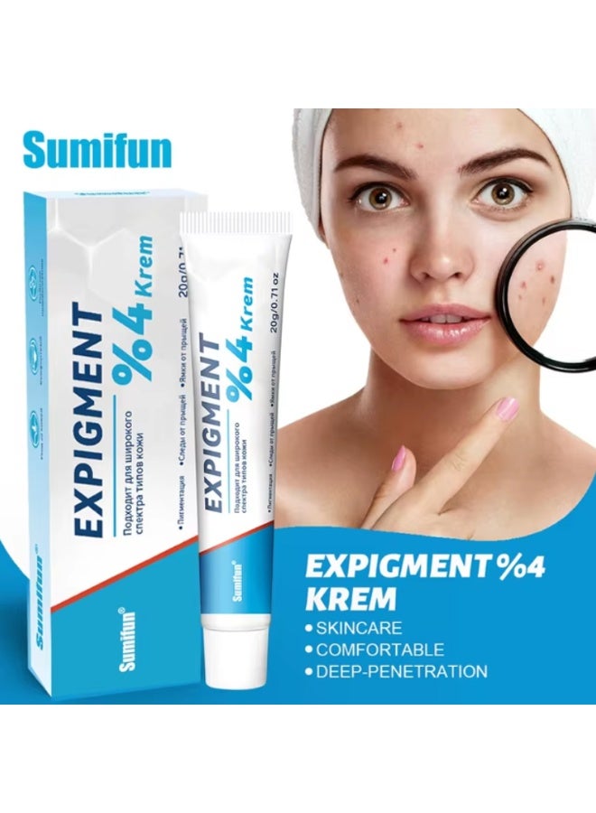 Expigment 4% Whitening Cream – For Pigmentation, Acne Scars & Uneven Skin Tone