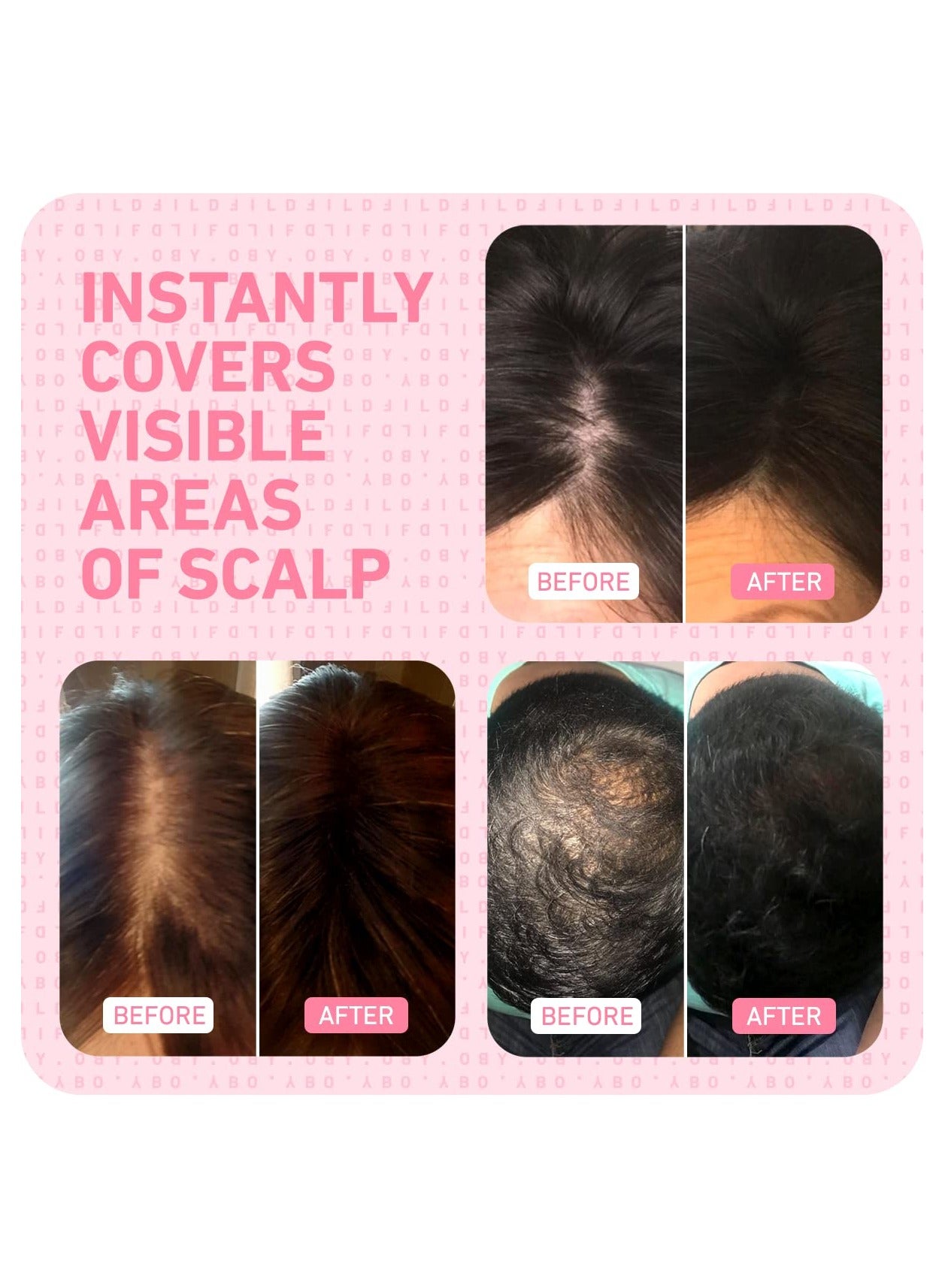 Hairline Root And Thining Cover-Up Powder For Instant Coverage – Conceals Thinning Edges And Gray Roots, Sweat And Rain Resistant, Dermatologist-Approved Scalp Safe Formula, Black (4G) - image 2