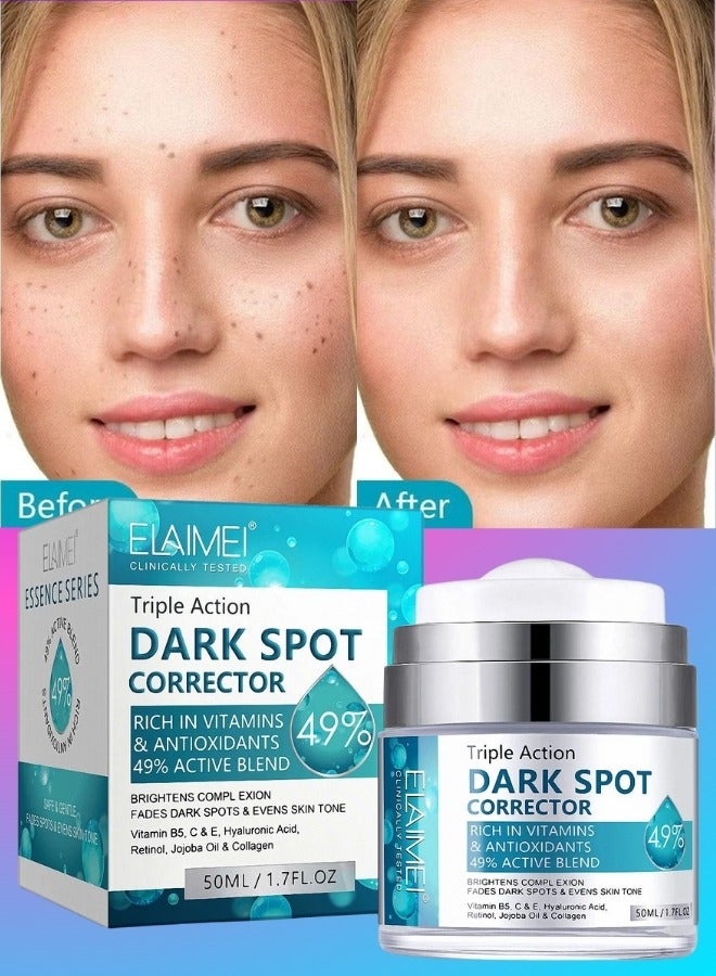 Triple Action Dark Spot Corrector 50ml Face Dark Spot Remover For Face And Body Sun Spot Remover Age Spot Corrector Brown Spot Remover Underarm Cream For All Skin Types