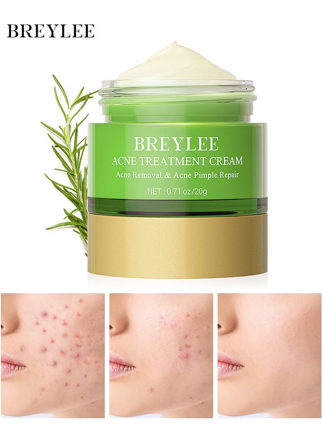 Acne Treatment Cream, Acne Removal Acne Pimple Repair Cream, Natural Cystic Acne Treatment, Premium Acne Scar Cream And Pimple Remover, 20G
