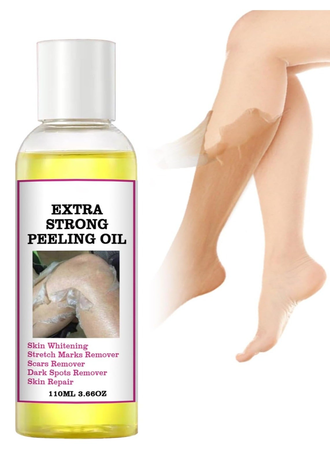 Yellow Peeling Oil, Peeling Oil for Dark Skin, Strong Peeling Oil Extra Strength, Exfoliating Peeling Solution for Body All Skin Type Dead Skin Remover
