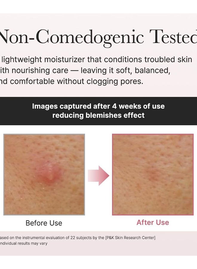 Red Smoothie Lotion 5, Face Moisturizer with Niacinamide 5%, Collagen, Peptide Complex, Hydrating Skin Care, 6.76 fl oz - image 4