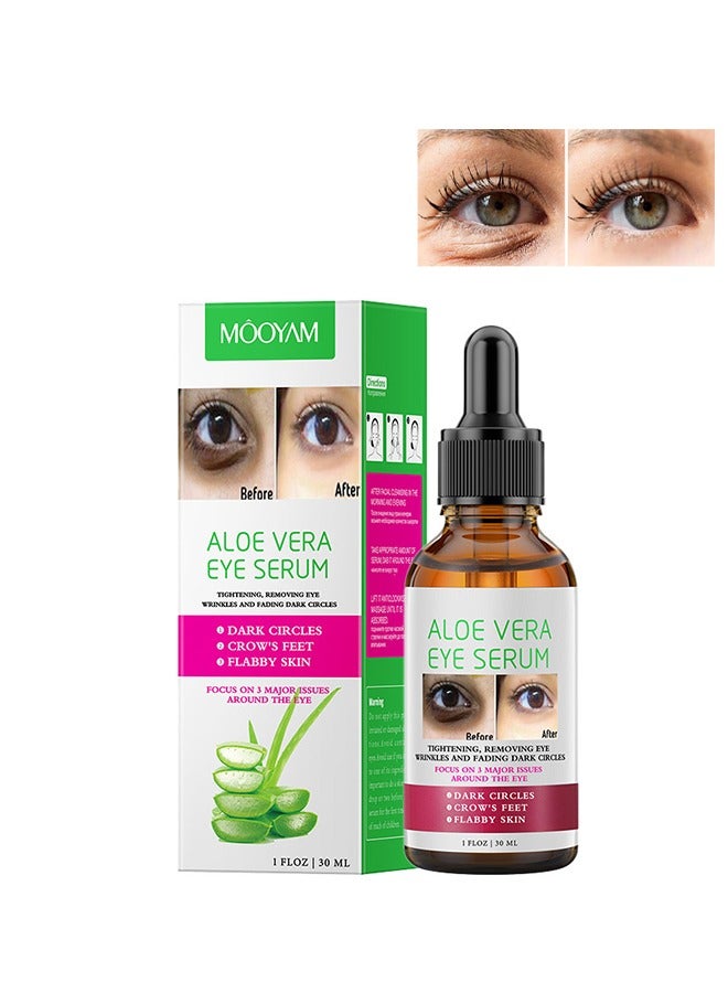 Aloe Vera Eye Serum for Dark Circles,Deeply Moisturizing,Anti Aging, Smooth Fine Lines and Crows Feet,Tightening and Lifts Eye Skin,Enhance Skin Elasticity,Fragrance Free 30ml