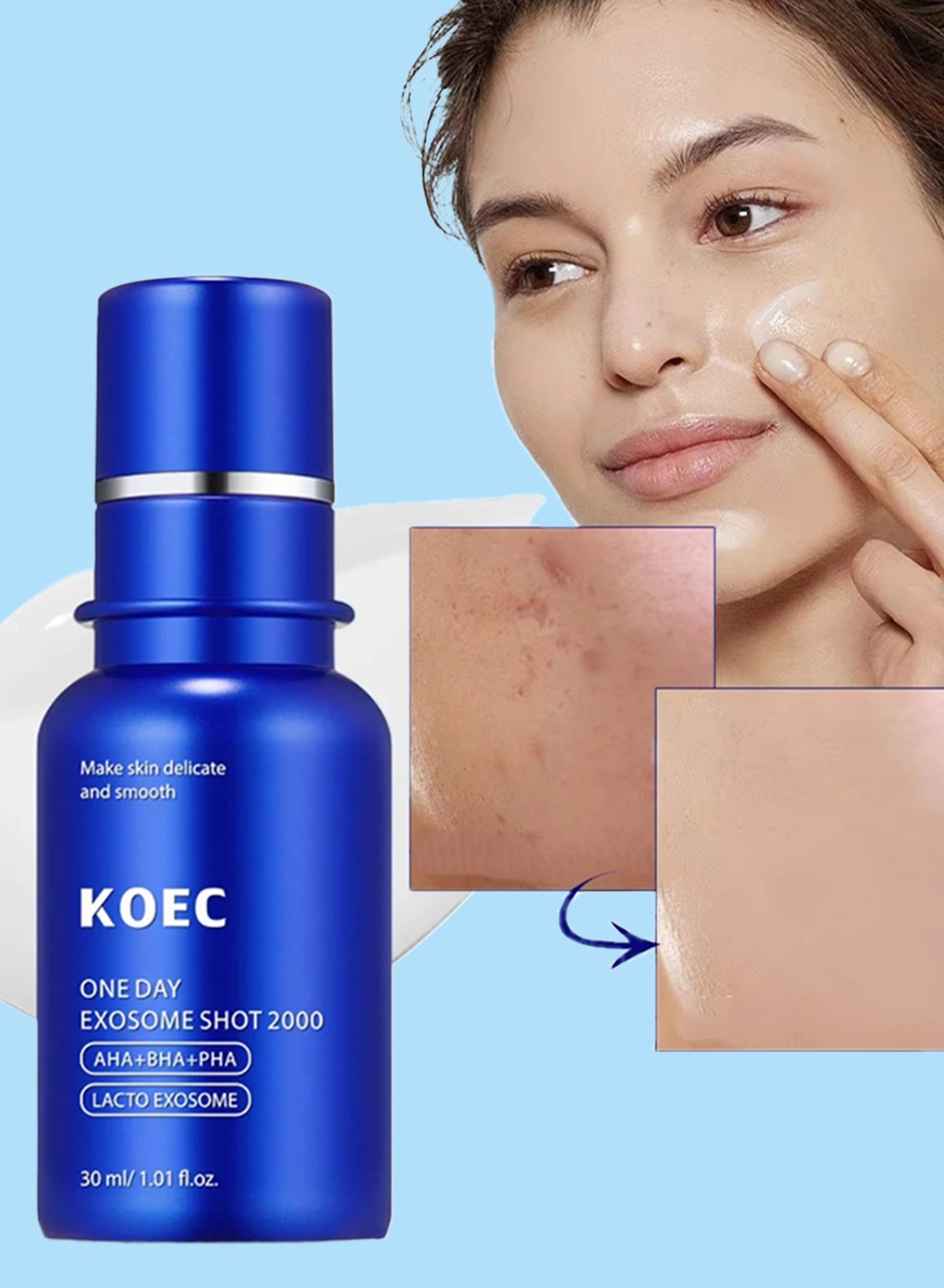 One Day Exosome Shot Pore Ampoule 2000 PPM Spicule Facial Serum AHA BHA PHA Pore Care Dead Skin Cells Liquid Skin Booster Serum Liquid Skin Booster Serum Face Gel moisturizer 30ml