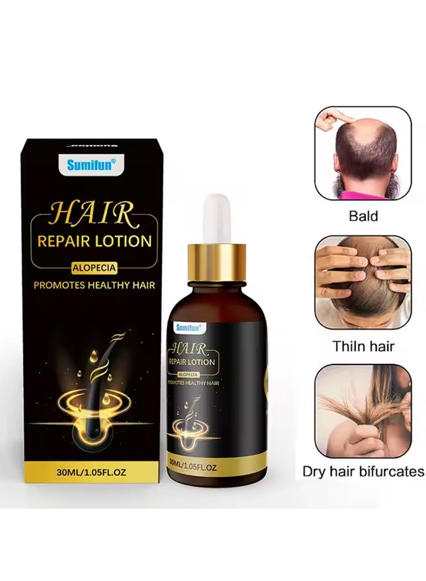 1PC 30ML Natural Organic Alopecia Hair Repair Lotion