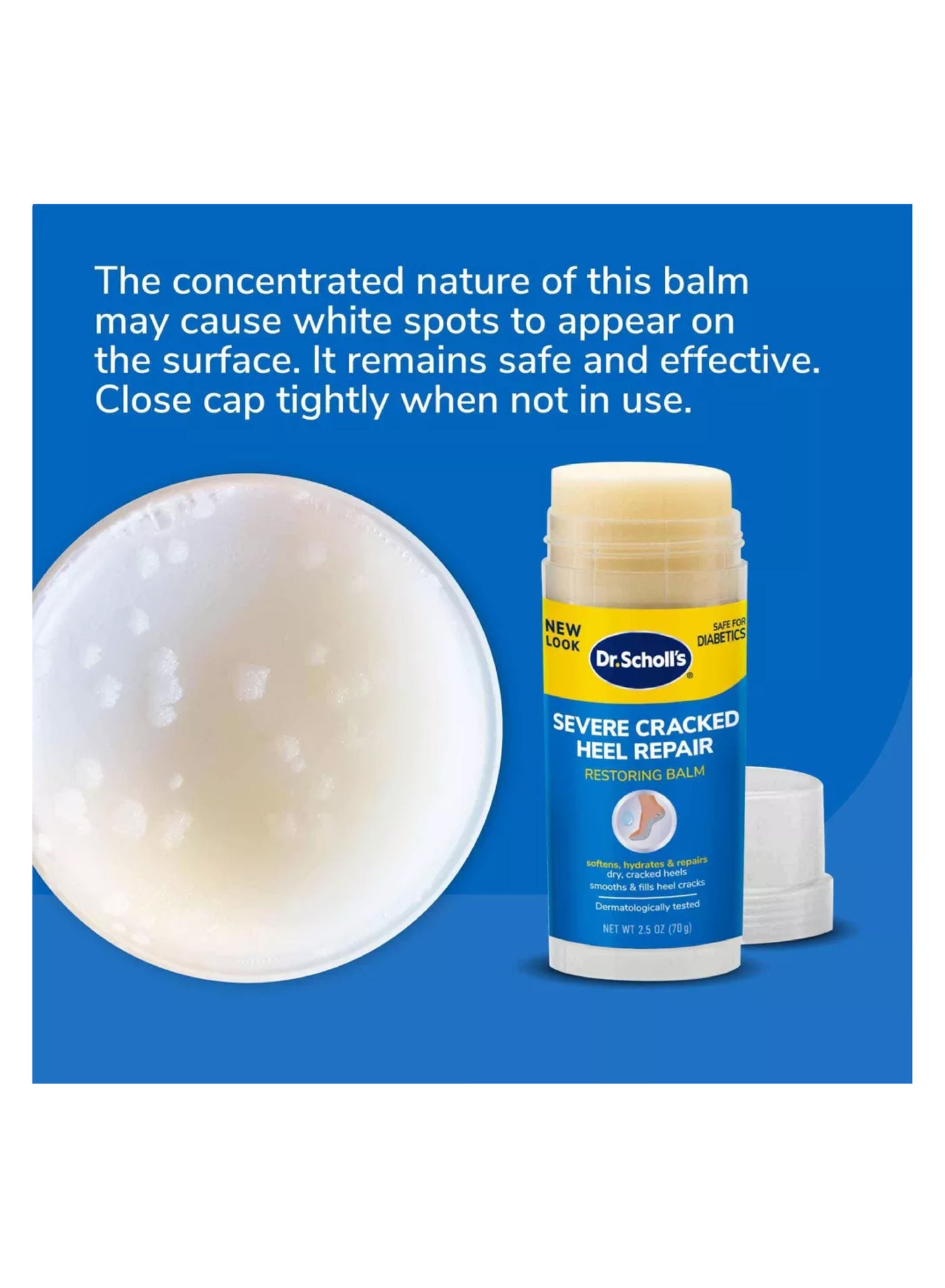 Severe Cracked Heel Repair Restoring Balm - Intensely Hydrates & Softens for Healthy Feet with 25% Urea (2.5 oz) - image 3