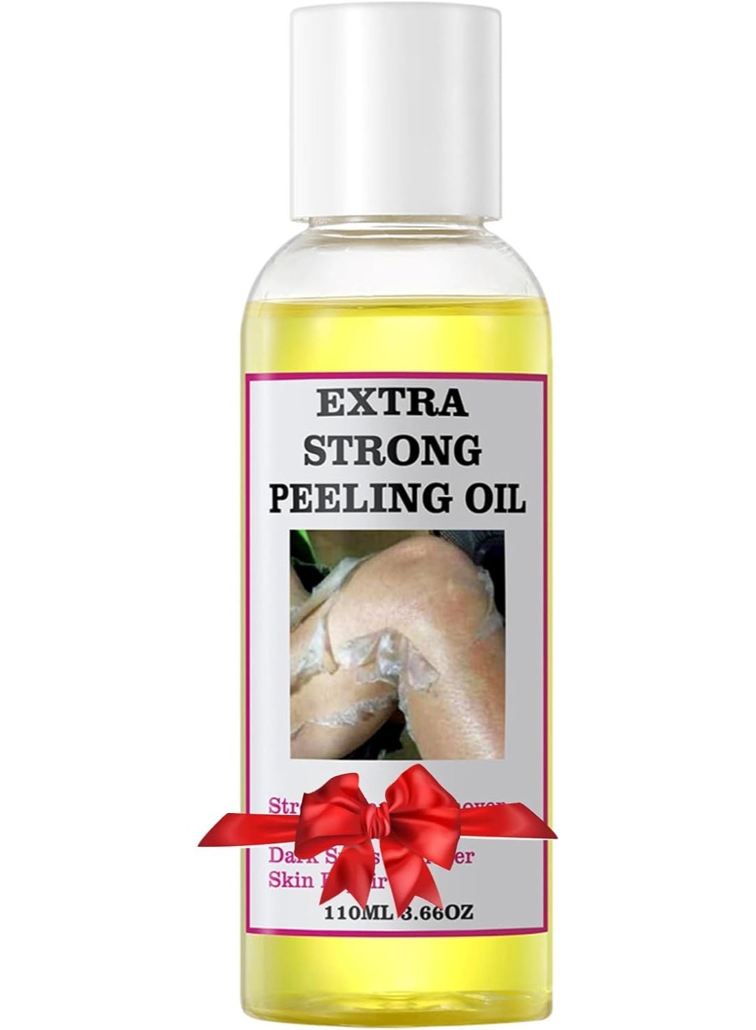Yellow Peeling Oil 110ml Super Strength Dead Skin Remover Skin Moisturizing Hydrating Butter Peeling Skin Brightening Peeling Solution for Dull Skin and Uneven Skin Tone