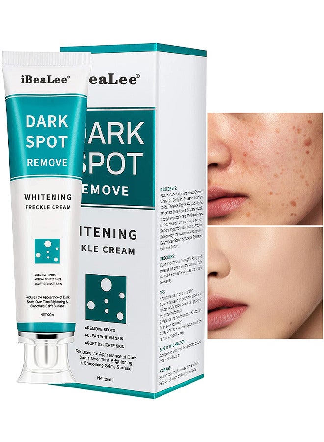Dark Spot Remover For Face Peeling Skin Whitening Freckle Cream Pigmentation Treatment Sun Spots Age Spots Blemish Remover Lightening Cream