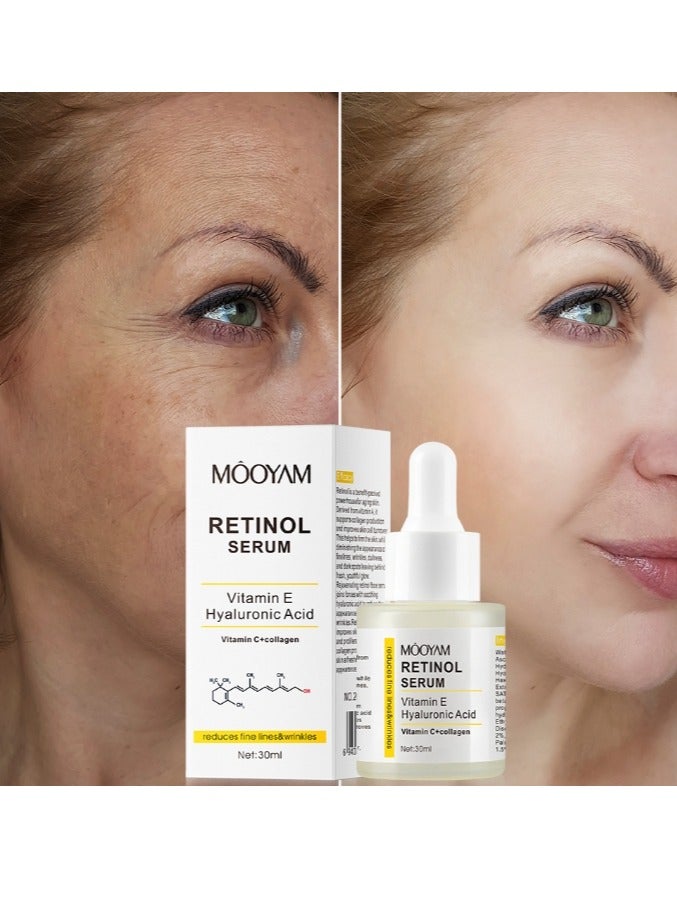 Retinol Anti Aging Facial Serum, Vibrant ​Glamour Retinol Serum,Containing Hyaluronic Acid, Retinol and Vitamin E, Moisturizing Anti Aging Reduces Dark Circle & Puffiness Serum 30ml
