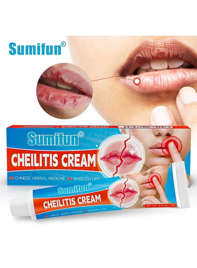 Cheilitis Cream, Healing Lip Balm For Severely Chapped Lips, Natural Ingredients For Instant Cooling and Pain Relief, Dead Skin Removal/Fade Lip Lines/Improve Lip Color 20g