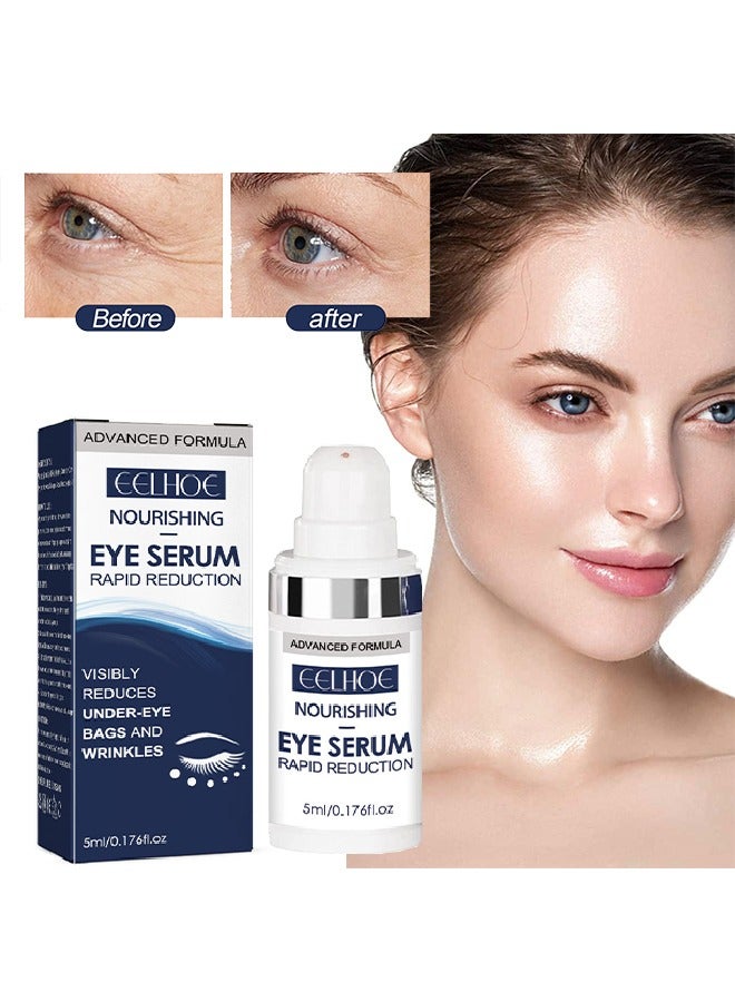 Nourishing Eye Serum ,Rapid Reduction Eye Serum - Anti Aging Serum Visibly Reduces Under-Eye Bags, Wrinkles, Dark Circles, Fine Lines & Crow's Feet Instantly