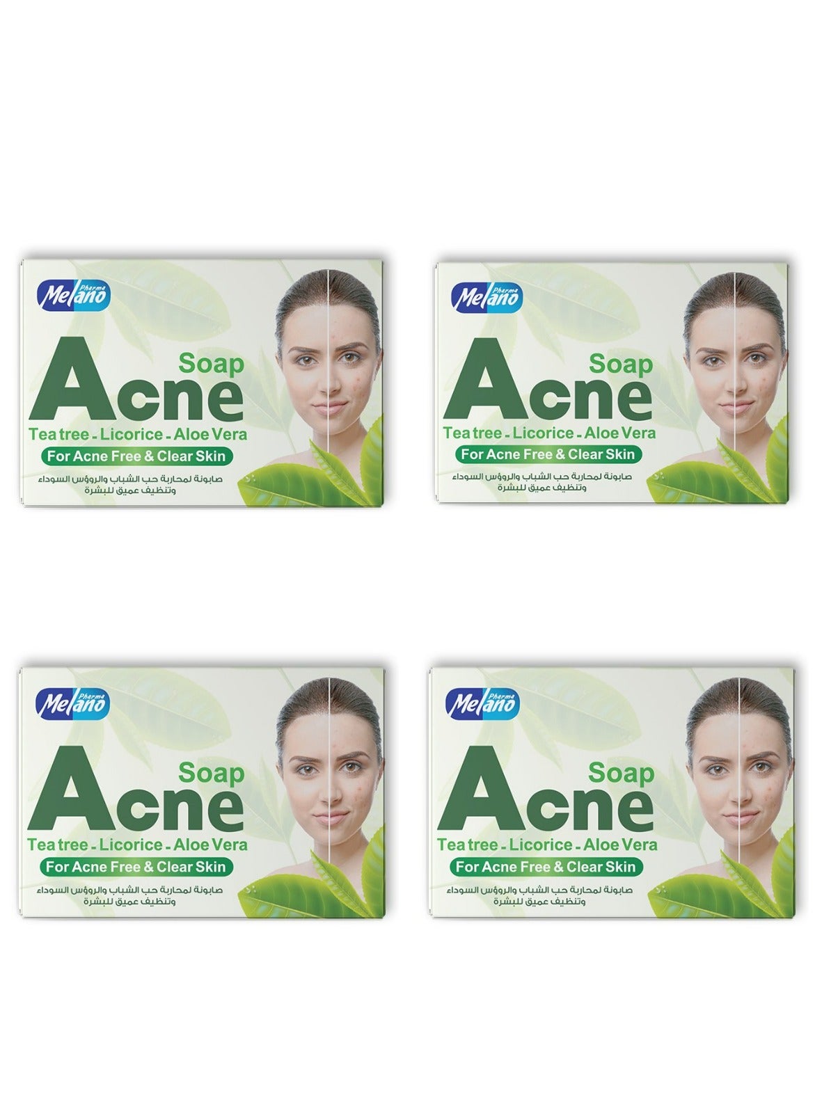 Acne Soap With Tea Tree-Licorice-Aloe Vera For Acne Free And Clear Skin 100 g 4 Pcs