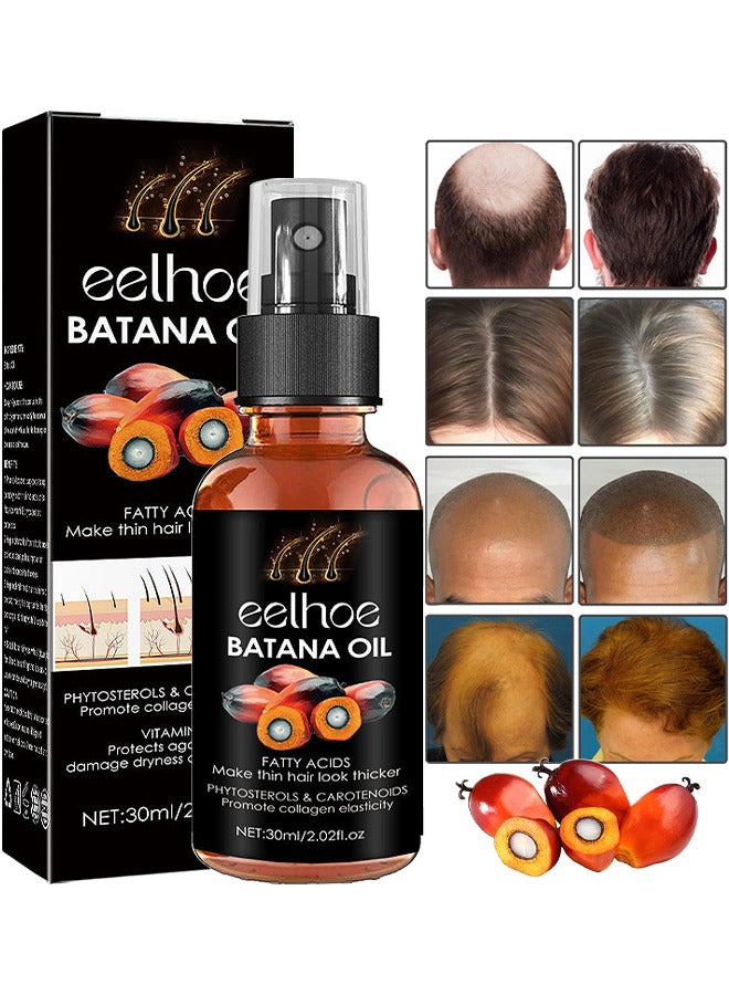 Batana Oil For Hair Growth, Batana Oil Organic For Healthy Hair, Repair Damaged Hair, Nourishes Thin Hair Scalp Skin And Loss Hair Growth Fir, Reduces Hair Loss, 30ML
