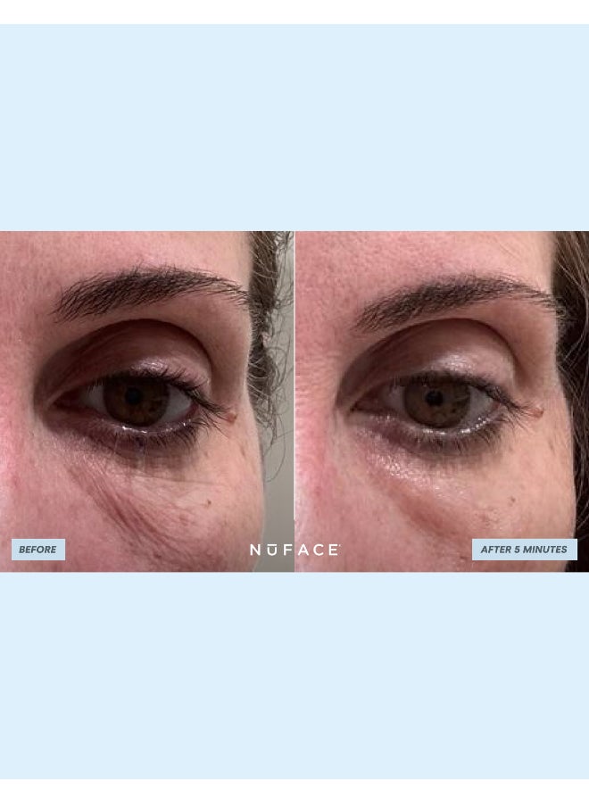 IonPlex® Hydra-Gel Power Patches (30 pairs eye patches) - image 9