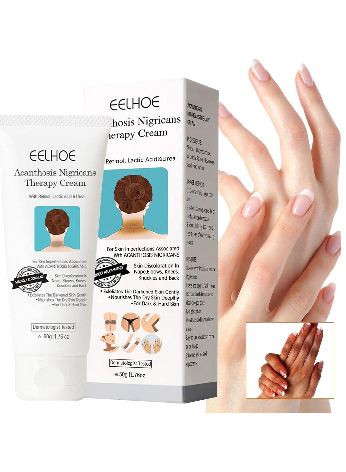 Acanthosis Nigricans Therapy Cream,50g Acanthosis Nigricans with Lactic Acid,Retinol Cream,Dark Spot Corrector Cream Serum