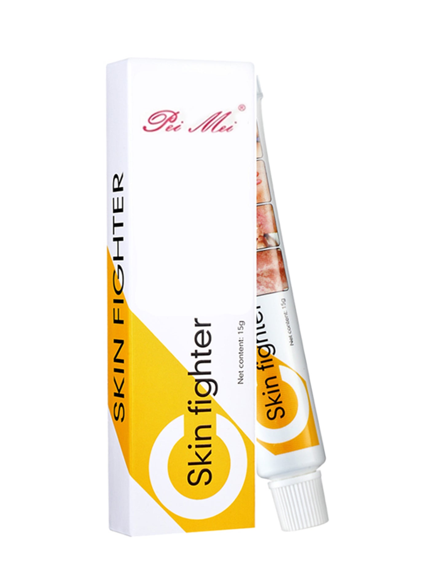 Skin Fighter Redness Soothing Skin Care Damaged Skin Repair Cream for Skin Allergies and Fungus Multi Purpose Skin Care Cream Psoriasis and Dermatitis Fighter Cream 15g