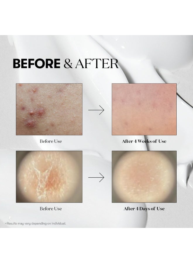 Mild Reedle Shot 50 50ml | Gentle Micro-Needling Essence for Sensitive Skin | Pore Care, Skin Texture Refining Serum - image 4