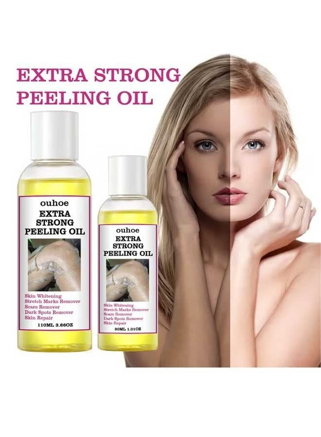 2Pcs Extra Strong Peeling Oil (30ml+110ml), Exfoliate Dark Skin, Super Whiten And Brighten Skin Tone, Exfoliating Peeling Solution for Body All Skin Type