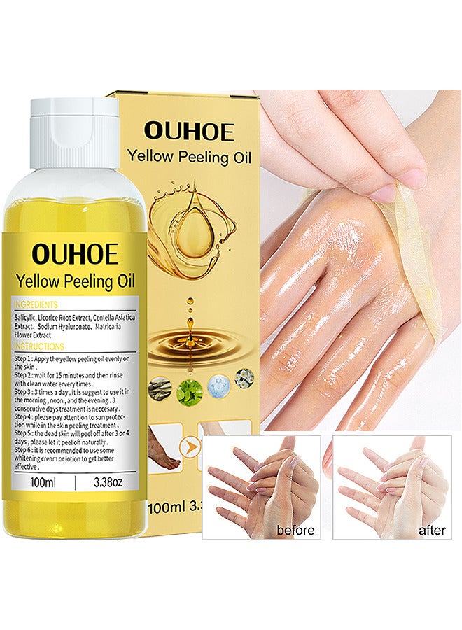 100ML Super Strength Yellow Peeling Oil Exfoliating Dark Skin For Body, Yellow Peeling Oil Body Whitening Skins, Butter Peeling Lightening Brighten Complexion For Cleansing And Moisturizing