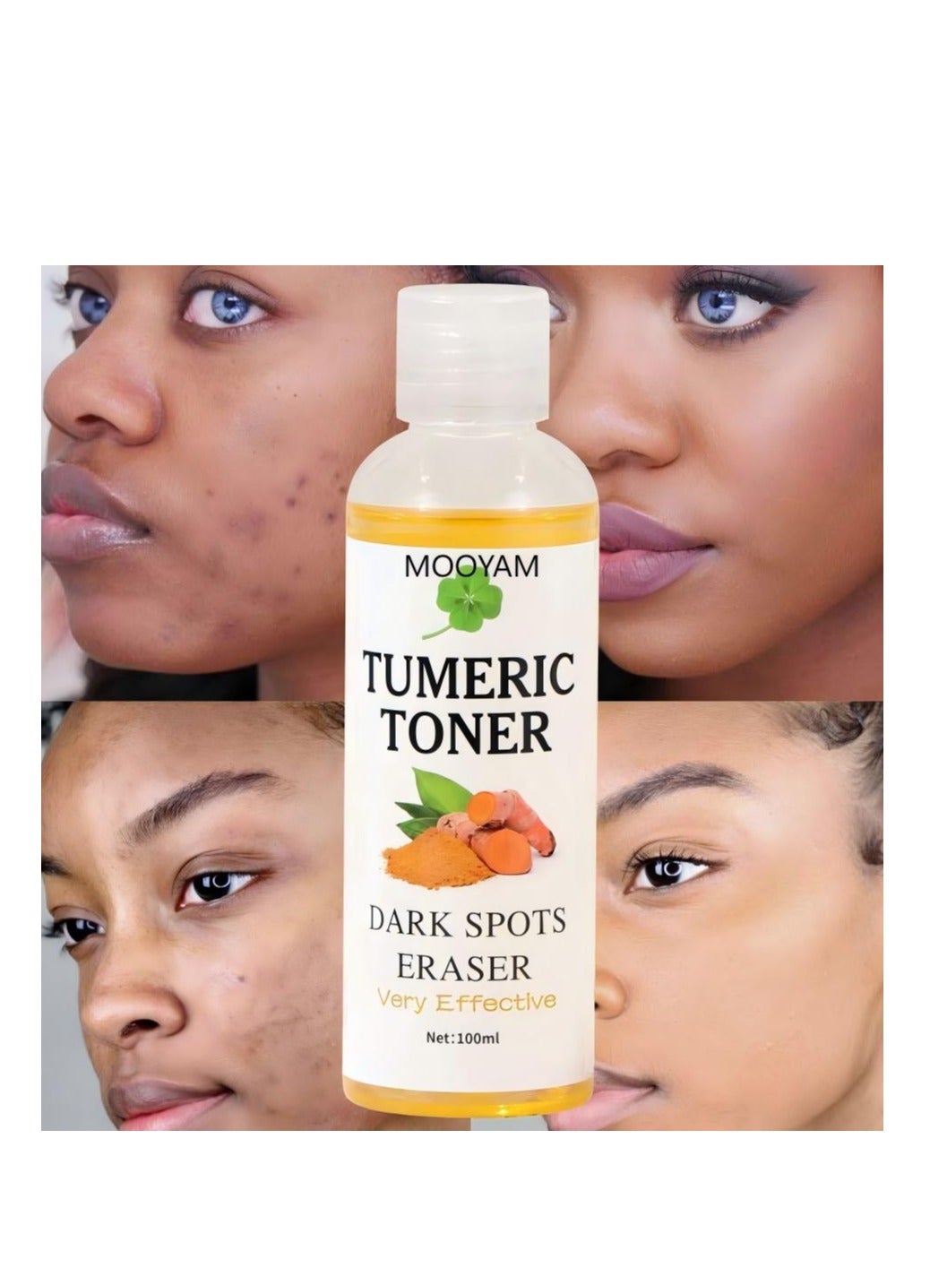 Turmeric Dark Spot Corrector Toner 100ML Facial Toner For Acne Prone Skin Dark Spot Remover For Face Hydrating Face Toner For Women Treatment