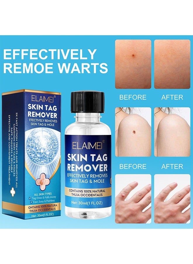 Skin Tag Remover - Wart Remover Fast Acting & Effective Wart Removal Treatment for All Skin Type 30ml