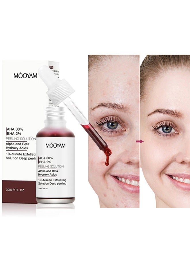 AHA 30% BHA 2%- Peeling Solution- Alpha and Beta Hydroxy Acids-Peeling Solution Anti Acne Serum,Chemical Peel for Face at Home,BHA+AHA  Liquid Exfoliant for Blemishes Wrinkle 30ml