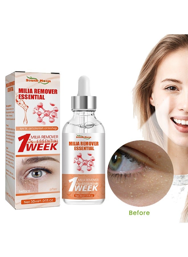 Milia Removal Essential, Milia Spot Treatment Helps Dissolve And Reduce Milia, Whitehead And Sebaceous Hyperplasia 30 ML