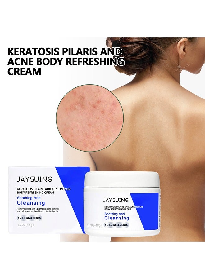 Soothing And Cleansing Keratosis Pilaris and Acne Repair Body Refreshing Cream -Removes Dead Skin,Promotes Acne Removal and Helps Restore The Skin Protective Barrier 48g