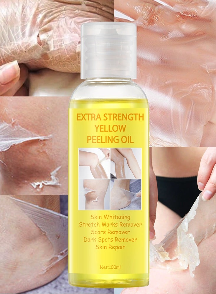 Yellow Peeling Oil Super Strength Dead Skin Remover Skin for Dark Skin, Face, Body, Dark Spots and Skin Lightening (100 ml) for Unisex, for All Skin Types