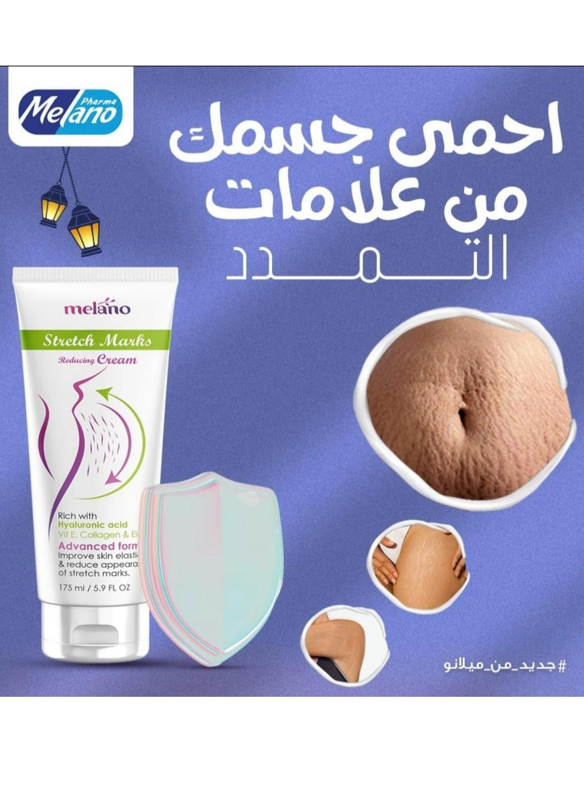Cream Stretch Marks