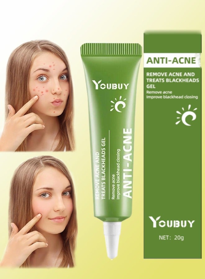 Anti Acne Remove Acne and Treats Blackheads Gel for Day Use Remove Acne Pimple and Treats Blackhead with Azelaic Acid Oil Control Shrink Pores Redness Relief Skin Lightening Scar Fade Cream Acne Remover Cream 20g