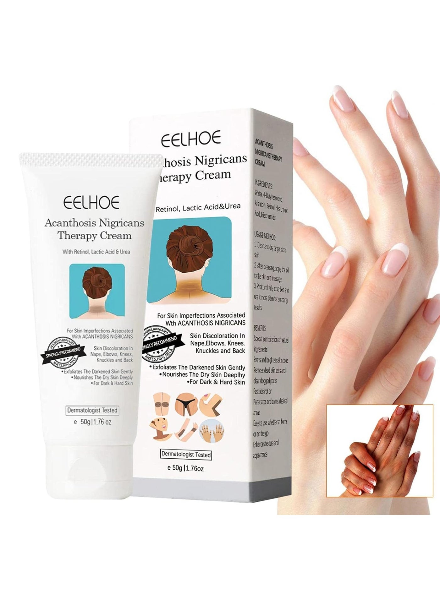 Acanthosis Nigricans Therapy Cream, Dark Spot Corrector Cream Retinol Cream, Nigrifix Cream with Lactic Acid, Removal of Hyperpigmentation for Dark Body Parts