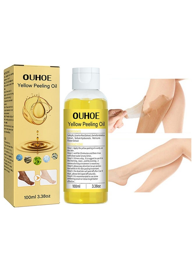 Yellow Peeling Oil Super Strength Exfoliating Dark Skin for Body,Skin Whitening Stretoh Marks Remover Peeling Solution with Salicylic Acid, Dark Spot Corrector for Body, Skin Brightening Peeling Solution for Dull Skin100ml
