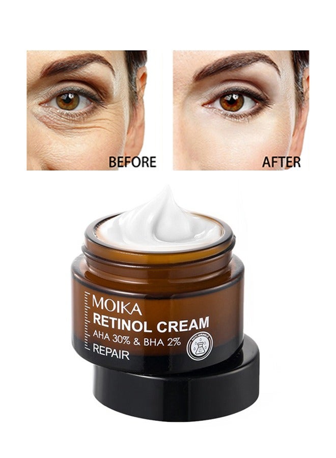 Retinol Cream AHA 30% & BHA 2%，Anti-Aging Retinol Cream For Skin Renewing And Cure Enlarged Pores 30g