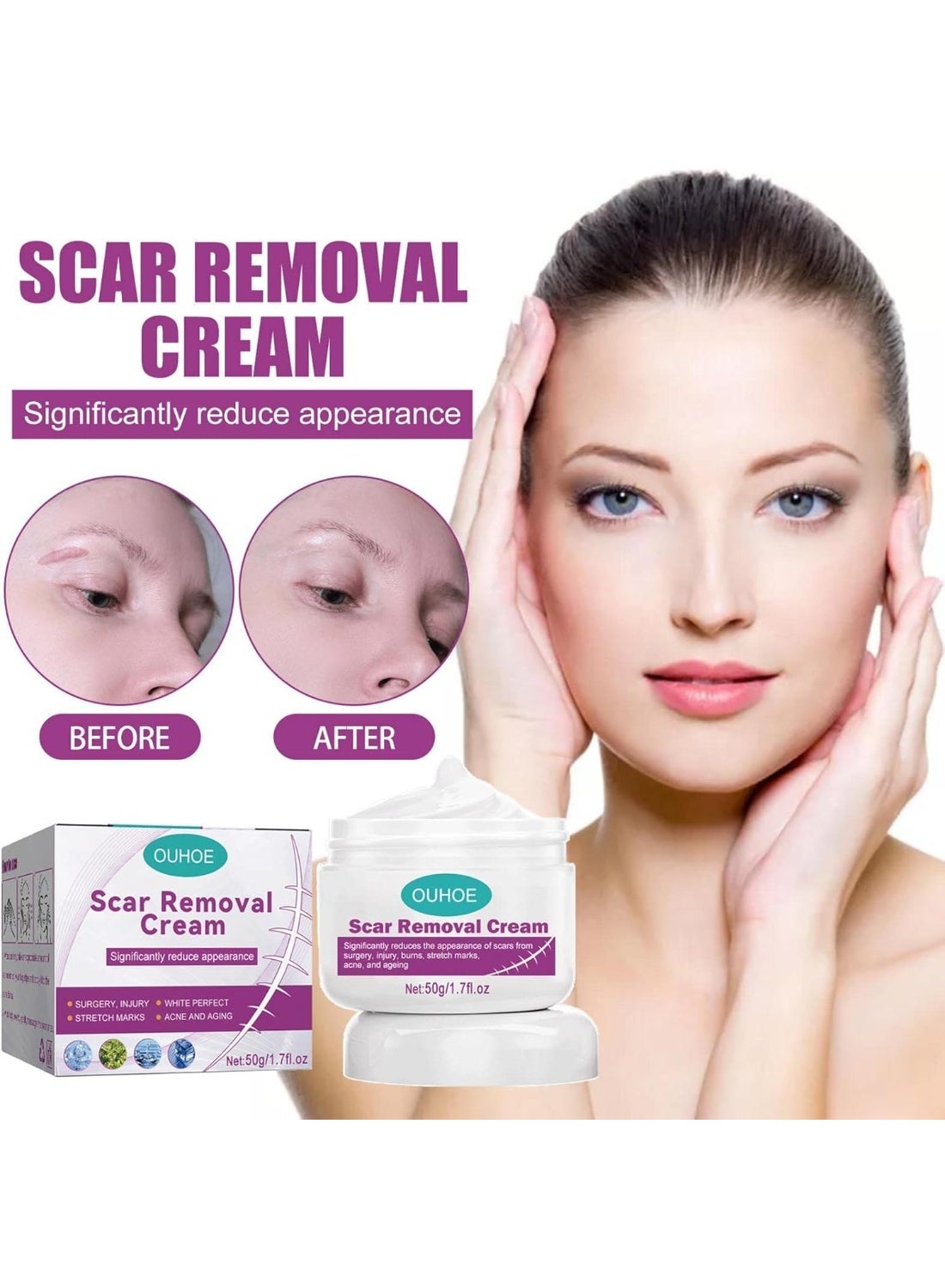 Scar Removal Cream - for Damaged Skin Dead Skin Elimination New & Old Scars Removal Cream Herbal Extracts Infused Burns Repair Face and Body Skin Repair Cream Unisex 50g